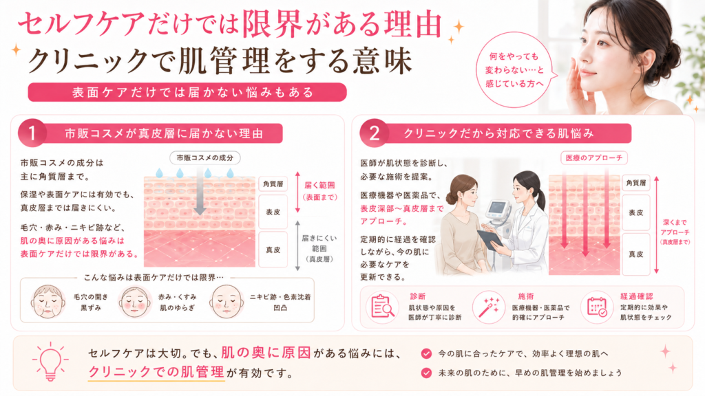 セルフケアだけでは限界がある理由イメージ画像