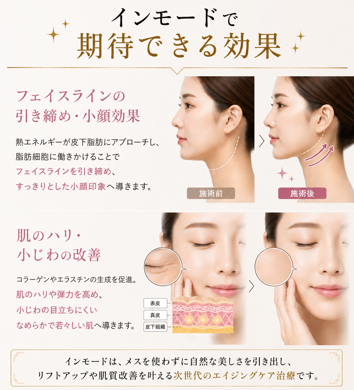 インモードで期待できる効果画像
