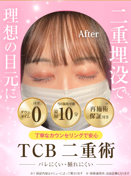 TCB東京中央美容外科 二重術クーポン